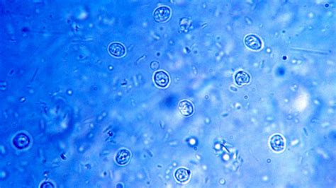  Cryptosporidium: Uma Ameaça Microscópica que Habita os Intestinos dos Animais!